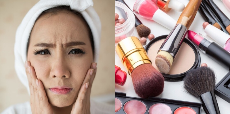 Kulit Muka Tiba-tiba Gatal – Mitos Atau Reaksi Sebenar?